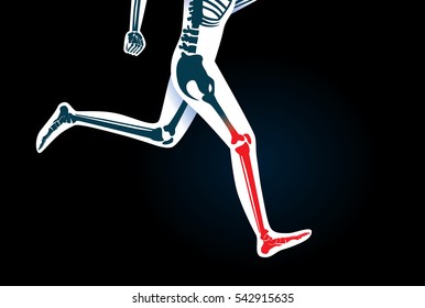 
Human Leg bone and foot while run have a red signal. This illustration about pain symptom on leg from movement or running.