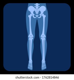 X線上の人間の脚の骨の解剖学 股関節 膝 骨盤 大腿骨 足とつま先 関節記号 Reontgenのベクターフラットコンセプトイラスト 白い背景に 医療用バナー のベクター画像素材 ロイヤリティフリー