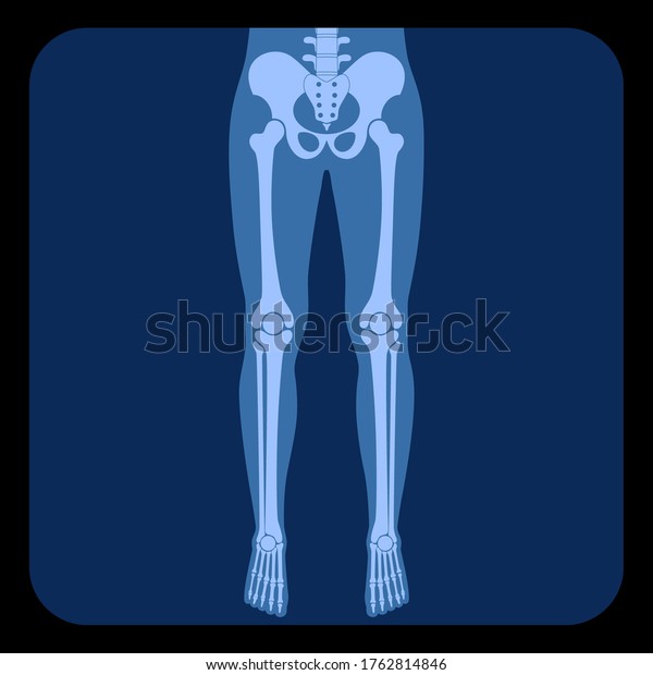 X線上の人間の脚の骨の解剖学 股関節 膝 骨盤 大腿骨 足とつま先 関節記号 Reontgenのベクターフラットコンセプトイラスト 白い背景に 医療用バナー のベクター画像素材 ロイヤリティフリー