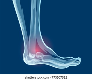 Human leg bones, x-rays. Mecial vector illustration.