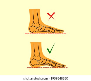 Human leg and joints. Symbol. Vector illustration.