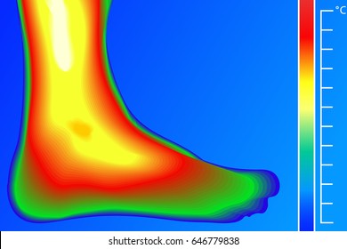 Human Leg Vector Illustration. Thermal Imager With Infrared Temperature Scale With Degrees Celsius. Actual Temperature And Emissivity Of The Human Body.