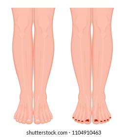 Human legs with ankle and knee. Vector illustration for advertising, medical (health care) publications. EPS 10.