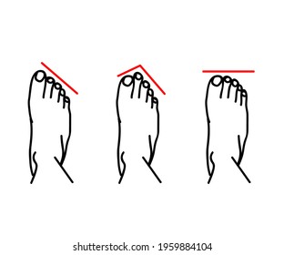 Human legs and variants of the structure of the feet. Symbol. Vector illustration.