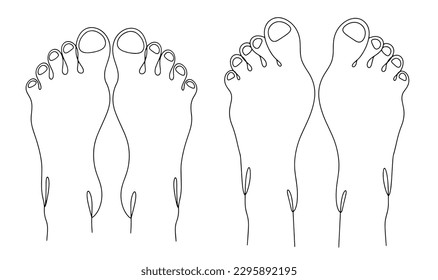 Human legs. View from above. Normal foot and valgus foot deformity. World Clubfoot Day. One line drawing for different uses. Vector illustration.