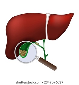 Human liver. Close-up of Gallbladder. magnifying glass examines gallstones into gallbladder. Biliary dyskinesia problems, Cholecystitis laboratory research. digestive system. Vector illustration