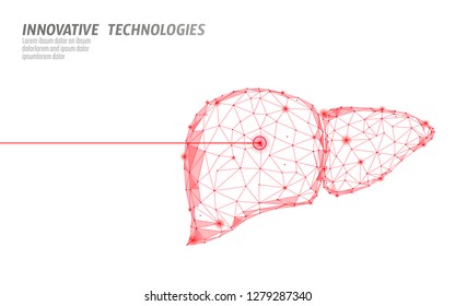 Human liver laser surgery operation low poly. Medicine disease drug treatment painful area. Red triangles polygonal 3D render shape. Pharmacy hepatitis cancer template vector illustration