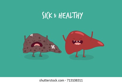 human liver, sick and healthy liver. Vector illustrations. Use for card, poster, banner, web design and print on t-shirt. Easy to edit.