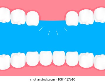 Human losing teeth in mouth. Info-graphic, dental care concept. Illustration isolated on blue background.