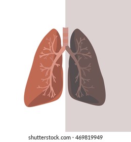 Human Lung Anatomy. Vector cartoon flat style Normal and cancer. Human Body Organs