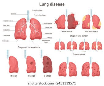 Human lung disease. Capillary dry cough. Inflammatory disease and pathological conditions of the airways. Coronavirus.
Respiratory system