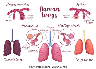 3,452 Realistic lungs Images, Stock Photos & Vectors | Shutterstock