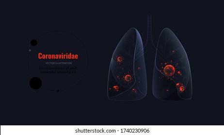 Human lungs affected by the COVID-19 isolated in black. Pandemic, epidemic, immunology, virology or coronavirus diagnostics concept. SARS, respiratory diseases, coronaviridae vector 3d illustration
