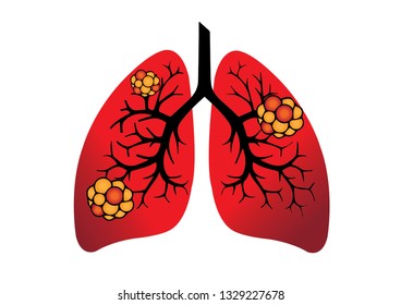 Human lungs anatomy and structure isolated on white background. Lung cancer and normal lung vector