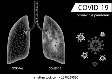 Human lungs compare between normal side and coronavirus disease damage ,Balck and white design vector