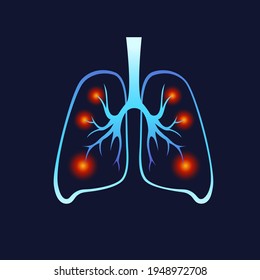 menschliche Lungen mit Covid-19. Entzündung in der Lunge Sarkose, Koronviren in der Lunge. Die schwere Krankheit SARS verursacht. Neon flach Stil. Medizin Symbol für Banner, Infografik, Vorlage. Vektorgrafik