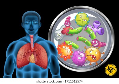 Pulmones humanos llenos de enfermedades en la ilustración de fondo negro