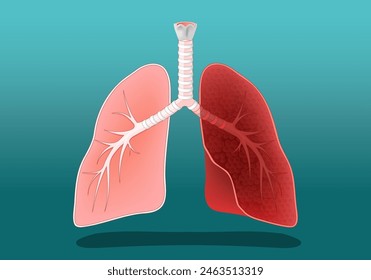 Human lungs. Healthy and diseased, inflamed or like lungs of a smoker, or a person with cancer. Vector poster. Isometric Flat illustration.