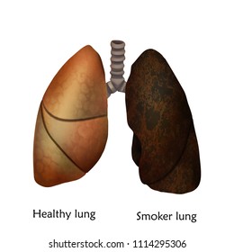 Human lungs. Healthy lung and smoker lung. Anatomy vector illustration. White background.