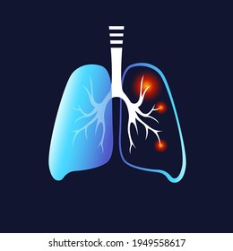 Human lungs with Inflammation.  Covid-19 in the lungs Sars disease, coronaviruse in the lungs. Causes the severe illness SARS . Neon flat style. Medicine icon for banner, infographic, template. Vector