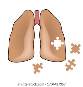 human lungs. lung diseases. vector illustration.