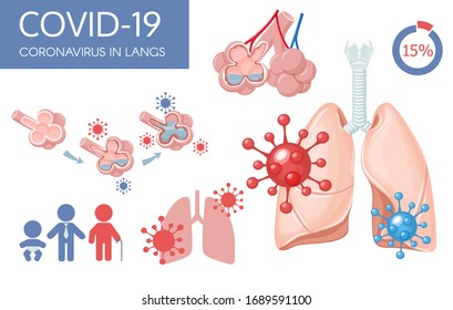 Human lungs. Sars disease, coronaviruses in the lung. Coronavirus. Covid-19 or 2019-ncov. Infographic symptoms virus in lungs with icons, infected organ. Coughing. Pandemic medical health risk concept