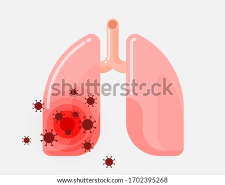 Human lungs sick by pneumonia, infected by virus, corona-virus pandemic theme, flat design illustration