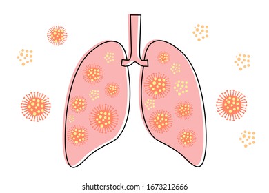 Human Lungs and trachea respiratory system anatomy affected with corona virus or pneumonia cosign high body temperature, vector outline