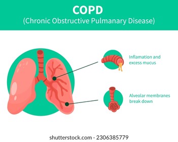 human Lungs vector clip art icon. COPD vector illustration, chronic obstructive pulmonary explanation