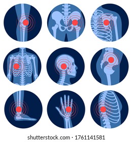 Dolor esquelético humano, fractura o inflamación, partes del cuerpo masculino a la vista de rayos X. Vector aislado de la ilustración plana del cráneo y los huesos en reontgen. Cartel médico, educativo o científico.