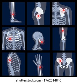 Human man skeleton pain, fracture or inflammation, parts of male body on x ray view. Vector isolated flat illustration of skull and bones on reontgen. Medical, educational or science banner.