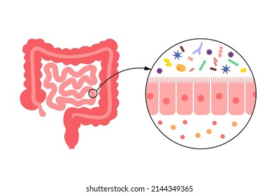 Human microbiome and intestine anatomical poster. Microbiota and surface area of intestinal walls. Intestinal villi and epithelial cells. Digestive system medical vector illustration in human body.