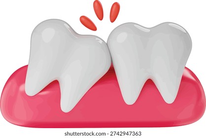 Human Molar Teeth With Impacted Wisdom Tooth Pressing Against Neighboring Tooth Causing Pain And Discomfort Dental Healthcare Medical Concept For Orthodontic Treatment Stomatology Surgery Oral Hygiene Professional 3D Rendered Illustration
