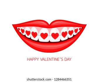 Human mouth with heart braces. Vector illustration isolated on white background. Dental care concept.