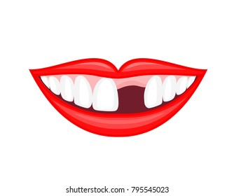 Human mouth with missing tooth. Dental care concept. Illustration isolated on white background.