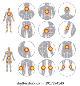 Siluetas de músculos humanos con puntos de dolor aislados en fondo blanco