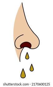 Human nose. Side view. The patient has a runny nose. Drops drip. Color vector illustration. Isolated background. The man caught a cold. Cartoon style. Medical theme. Idea for web design.