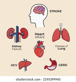 Human Organ Symptoms Brain Kidney Lung Stock Vector (Royalty Free ...