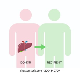 Human organ transplantation concept. Vector illustration of donor and recipient of liver organ