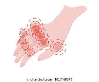 Human pain in the fingers with red pain circle flat vector illustration on white background