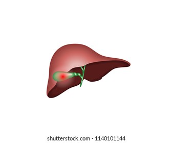 Human pancreas problems