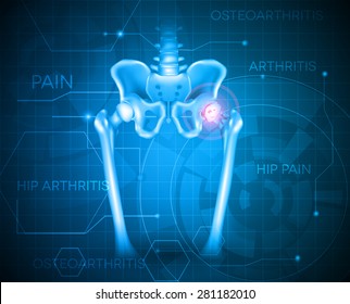 Human pelvis hip pain, abstract blue background. Hip arthritis