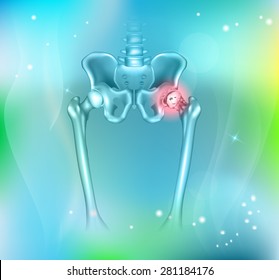 Human pelvis hip pain, abstract blue background. Hip arthritis
