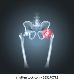 Human pelvis hip pain on a dark radial background