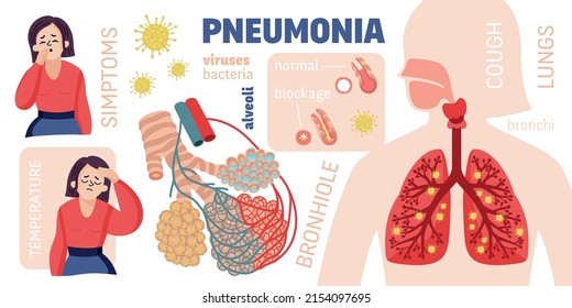 Human Pneumonia Infographics Cartoon Style Female Stock Vector (Royalty ...