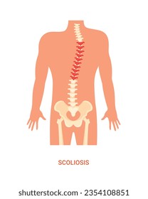 Human Posture Design Vector of Scoliosis Diagnosis