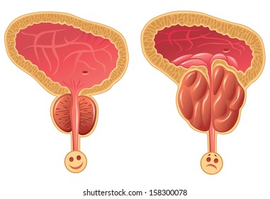 Human Prostate Gland