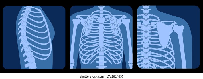 Human rib cage anatomy flat vector illustration in front, profile and back on x ray view. Man torso skeletal system. Anatomically correct chest ribcage. Medical, educational and science banner