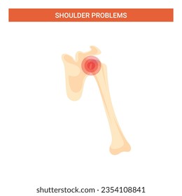 Human Shoulder Problems Vector Infographic