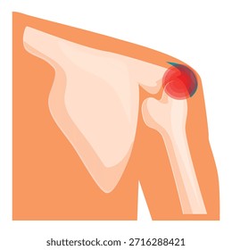 Hombro humano que muestra huesos y articulaciones resaltados en rojo que indican dolor